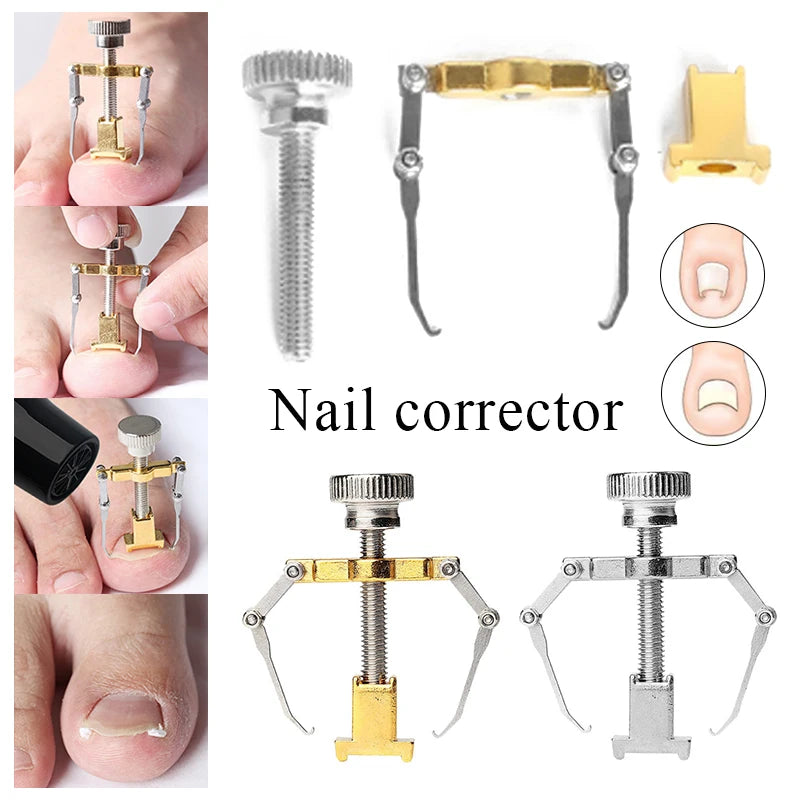 Hot Ingrown Toenail Corrector Nail Straighten Clip Ingrown Toenail Lifter Stainless Steel Paronychia Corrector Foot Care Tool