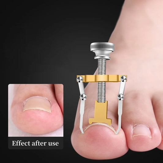 Hot Ingrown Toenail Corrector Nail Straighten Clip Ingrown Toenail Lifter Stainless Steel Paronychia Corrector Foot Care Tool