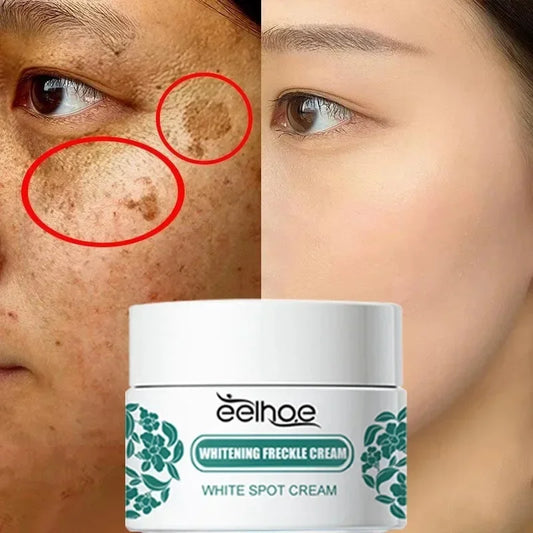 Niacinamide Melasma Brightening Cream Reduce Melanin Chloasma Brighten Dark Skin Fade Fine Face Lines Face Care Products