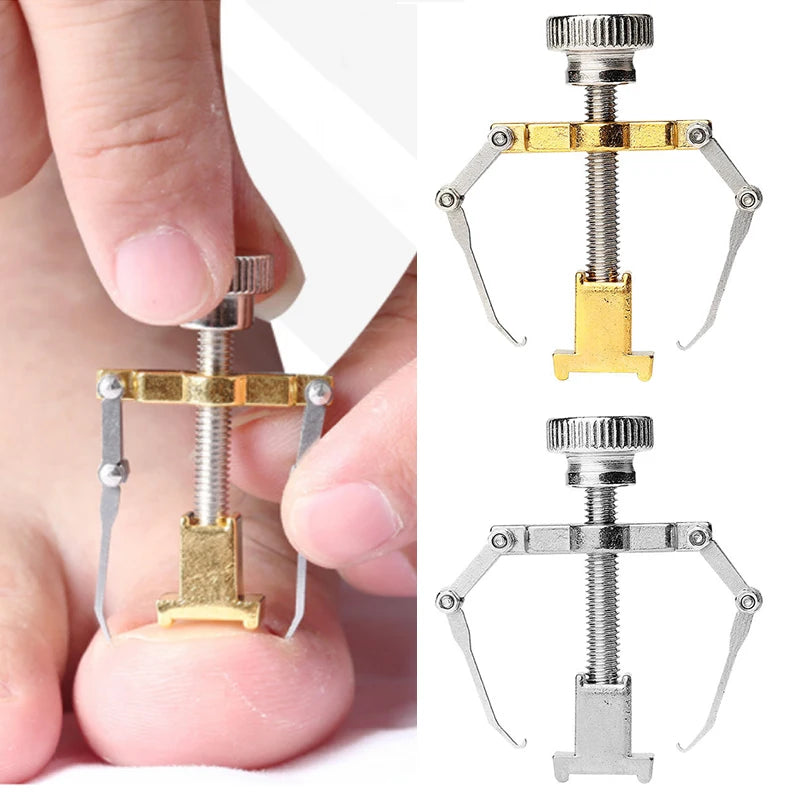 Hot Ingrown Toenail Corrector Nail Straighten Clip Ingrown Toenail Lifter Stainless Steel Paronychia Corrector Foot Care Tool