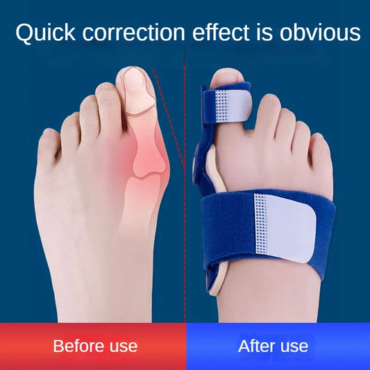 Corrector Adjustable Hallux Valgus Big Toe Corrector Rotatable Toe Corrector Straightener Adjustable Toe Correction